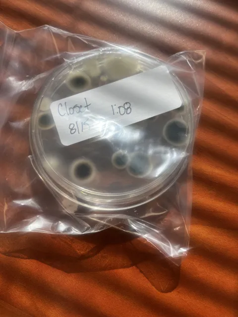 A labeled round sample dish enclosed in a clear plastic bag; dark patches are visible in the dish. The collection does not explain the test or its findings. Alternate view 3.