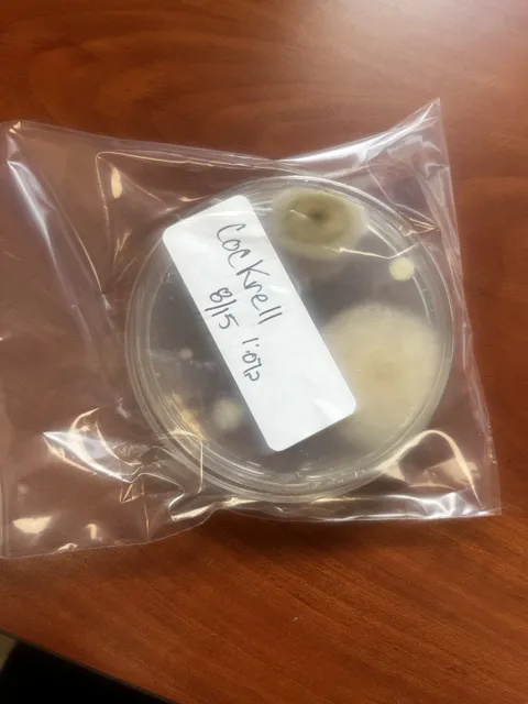 A labeled round sample dish enclosed in a clear plastic bag; dark patches are visible in the dish. The collection does not explain the test or its findings. Alternate view 11.